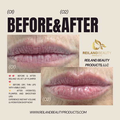 Instant Lip Plumping Treatment – Before & After Fuller, Hydrated Lips