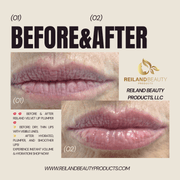 Reiland Velvet Lip Plumper – Anti - Aging, Instant Volume & Hydration 💋✨ - Reiland Beauty Products, LLC