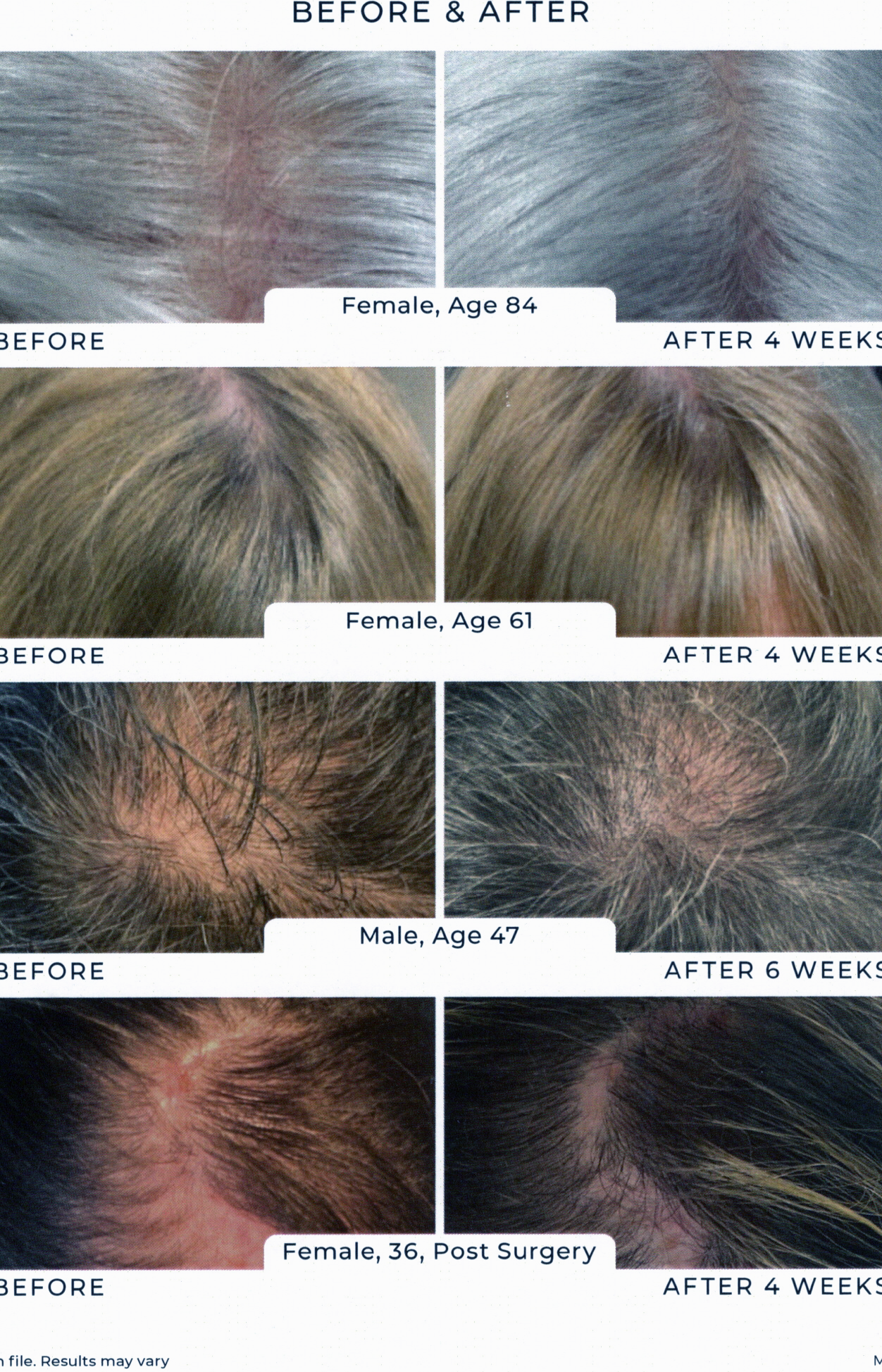 Stronger, Healthier Hair with Reiland Advanced Hair & Scalp Shampoo