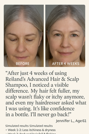 Before and after hair growth results of Jennifer L., age 61, using Reiland Advanced Hair & Scalp Shampoo. Noticeable reduction in thinning areas and improved scalp health after 4 weeks. Features natural ingredients including Postbiotics, Oat Amino Acids, and Salicylic Acid.